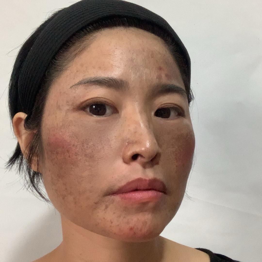 想要好皮肤的姐妹进