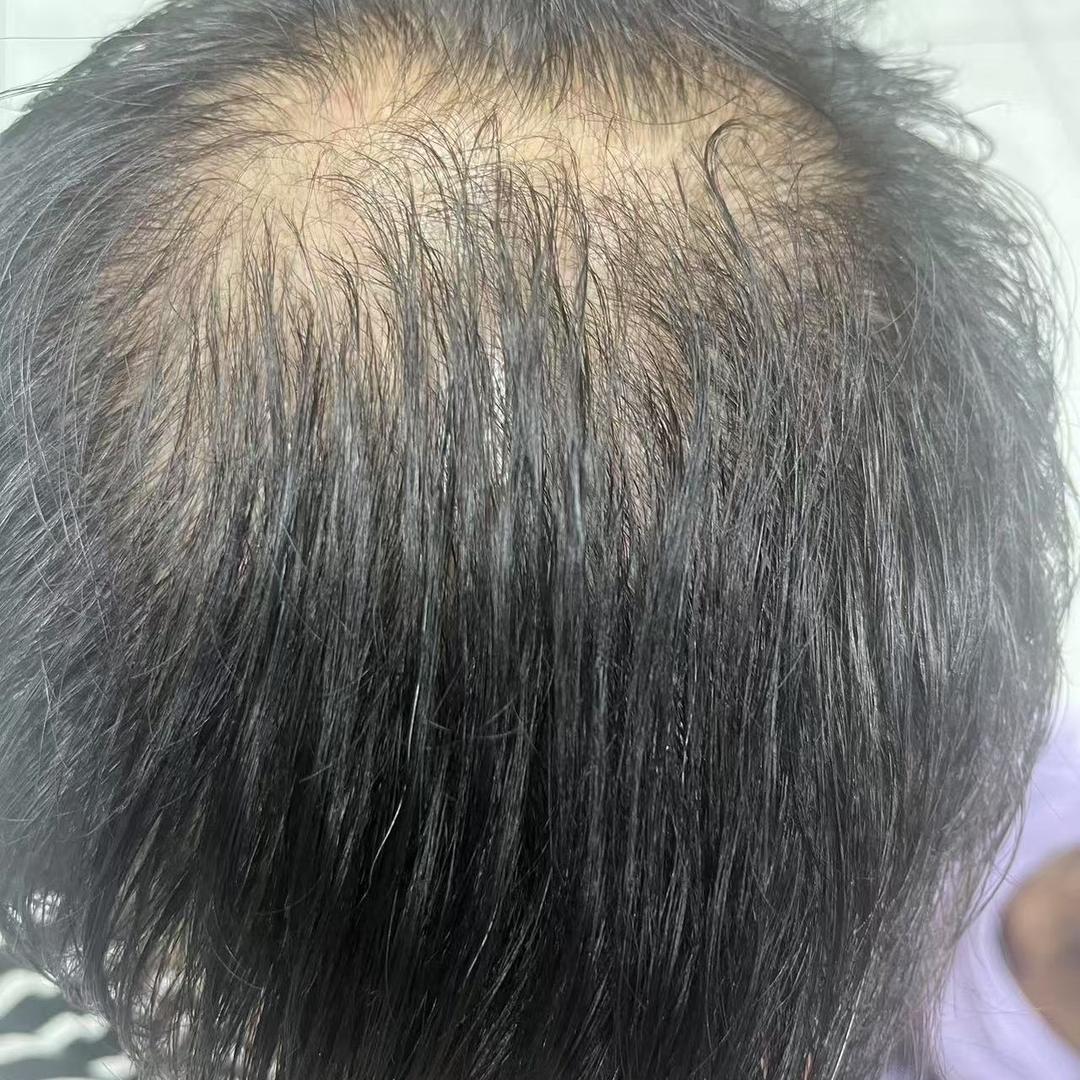 碣石设计（头发少的）