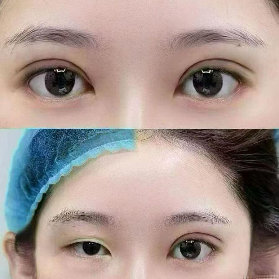张院美学