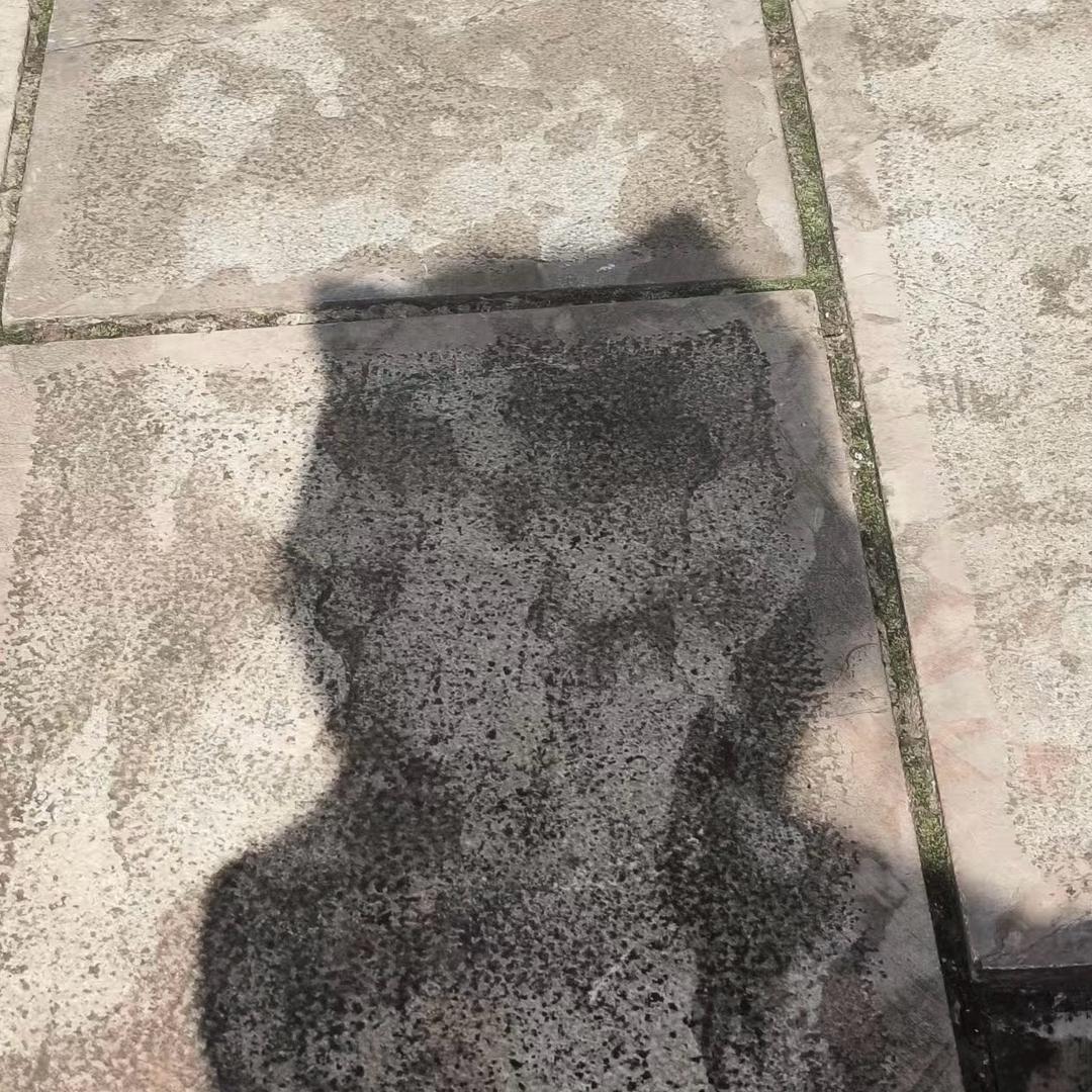 喝蛋白粉增肌挤爆男大18厘米痔疮