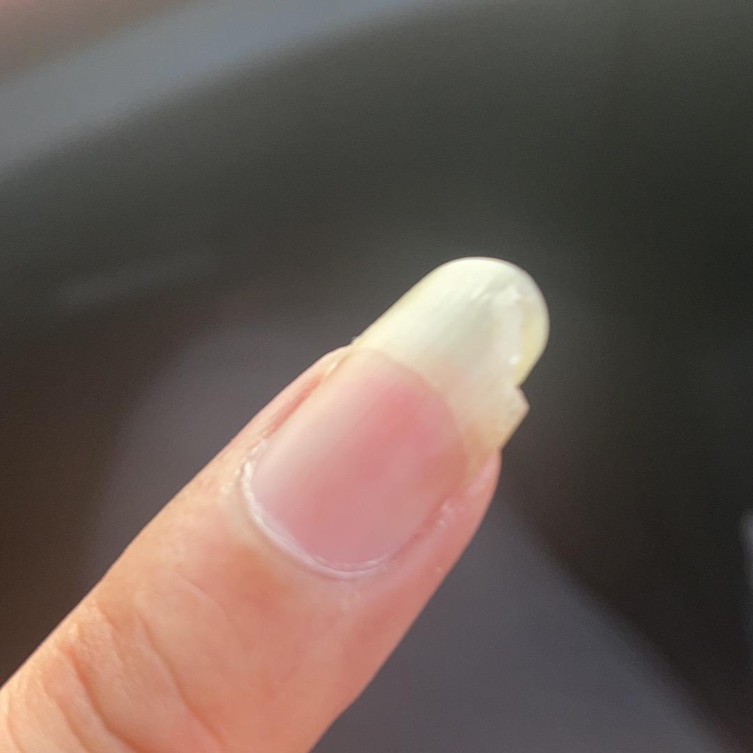 态度就是答案