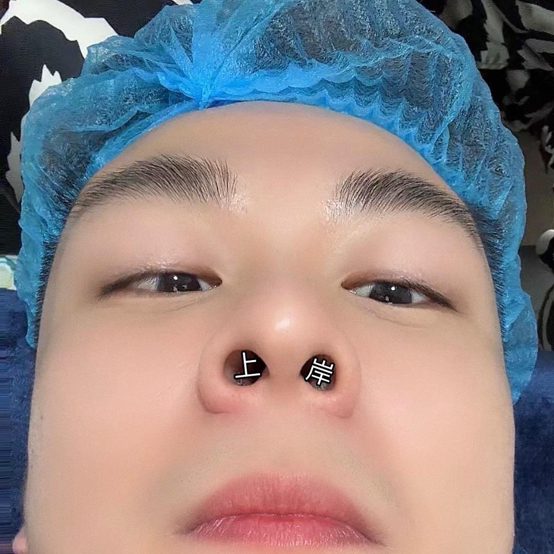 男护老薛🫃🏻
