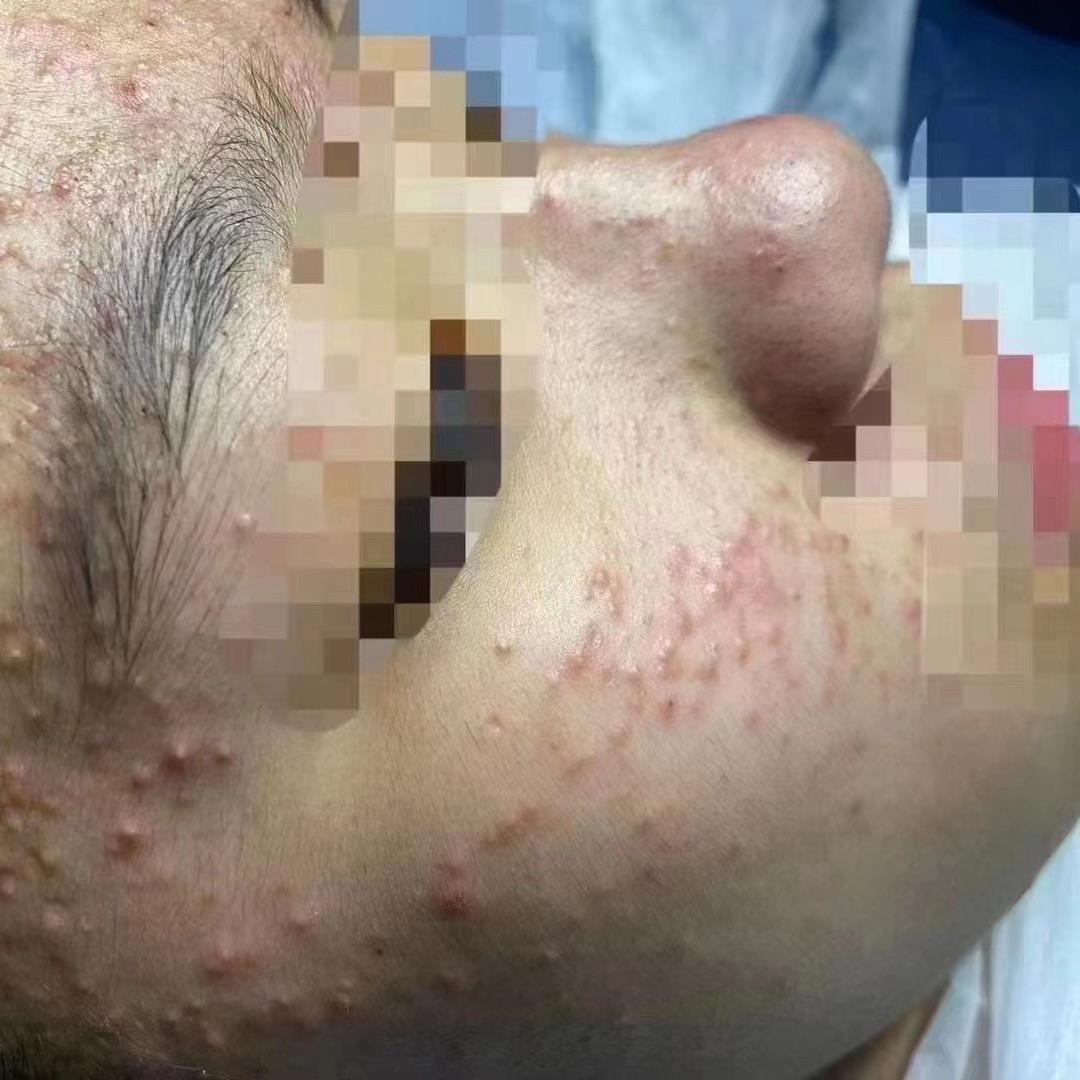 佰草慕安徽淮北祛痘祛斑二手皮肤回收包包