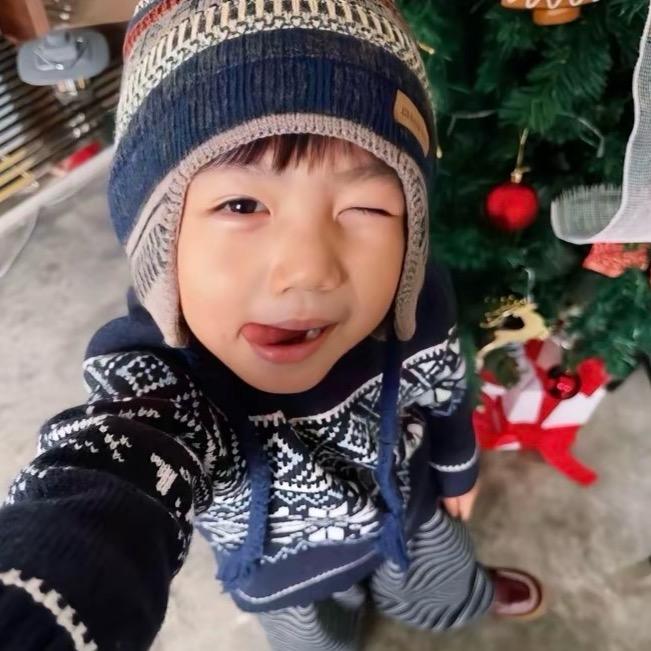 为什么我没有双眼皮