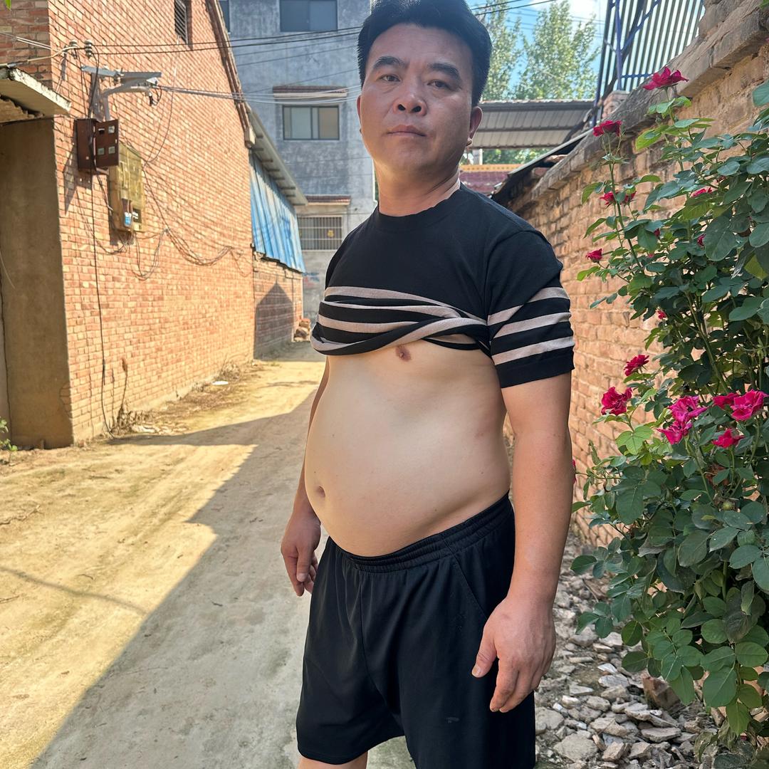 森弟 逆袭30