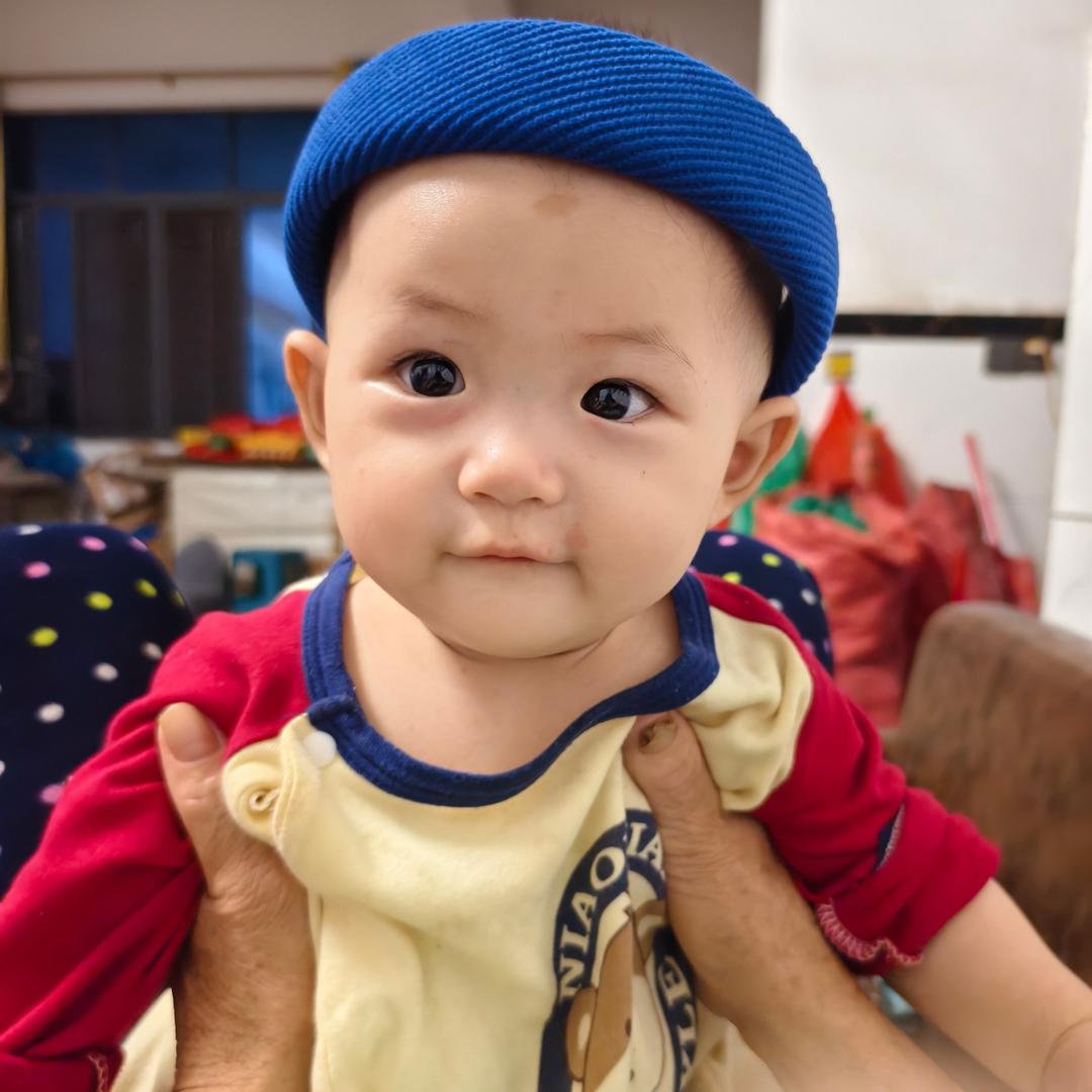 小小凤（抗疤中）