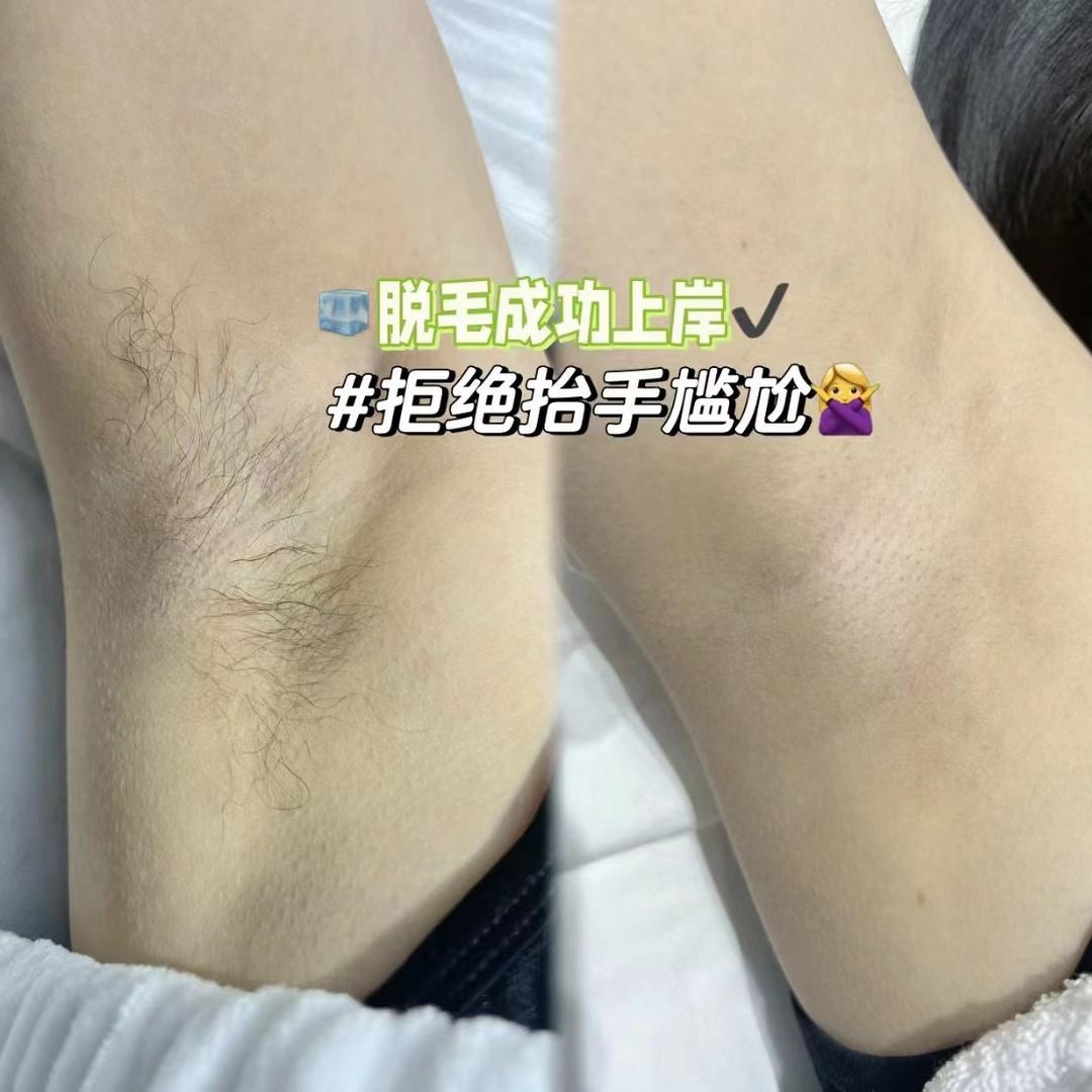 汝州市佑佑美睫脱毛