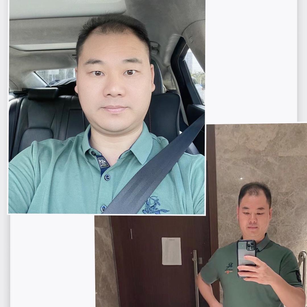 阿明哥