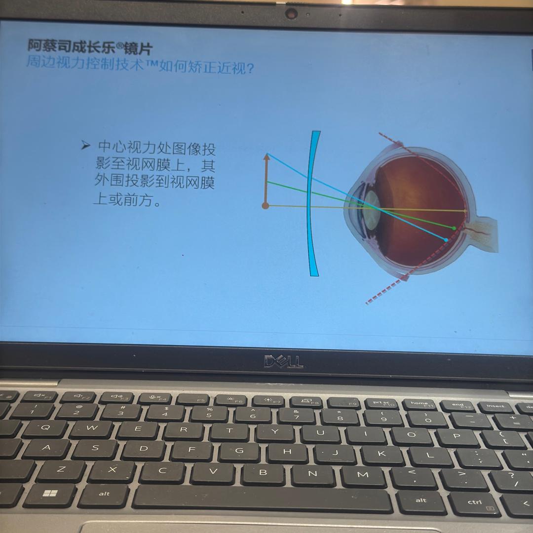 拉萨东郊万达AOJO眼镜店～次珍