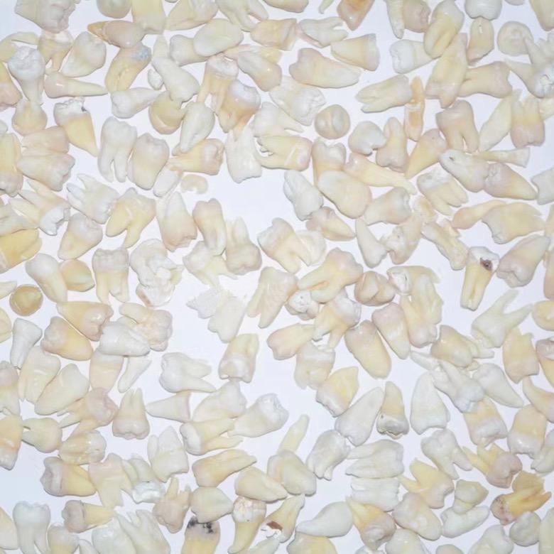 牙🦷（离体牙）