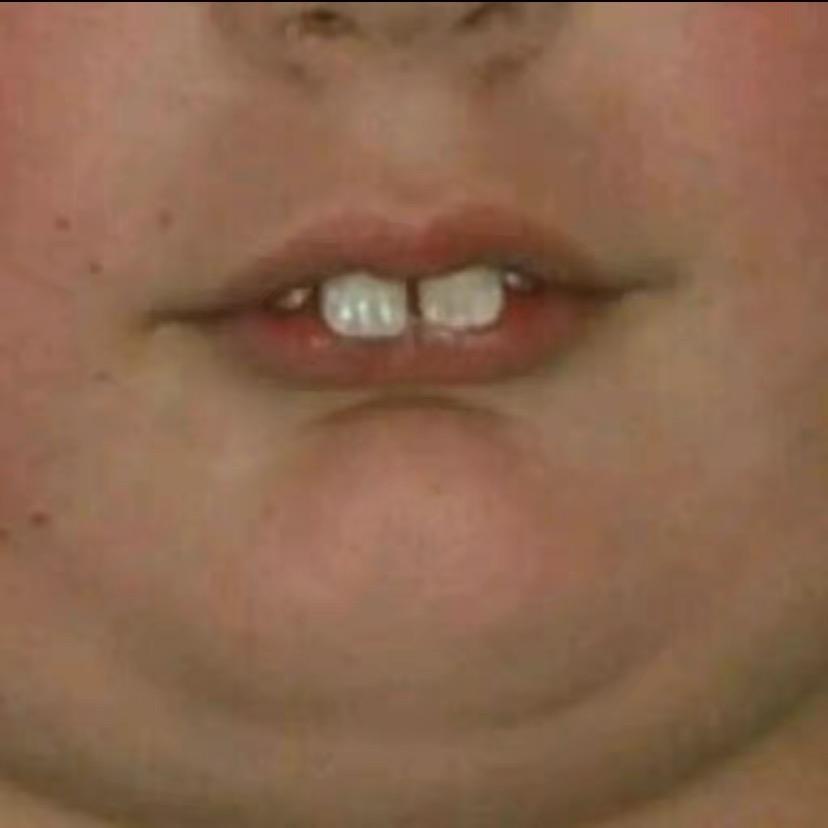 ·你要喝粥吗🎐