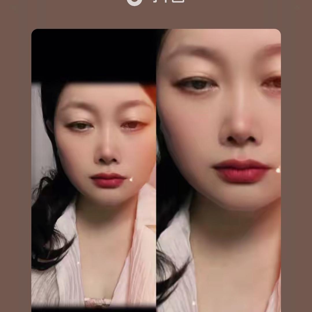 玲玲
