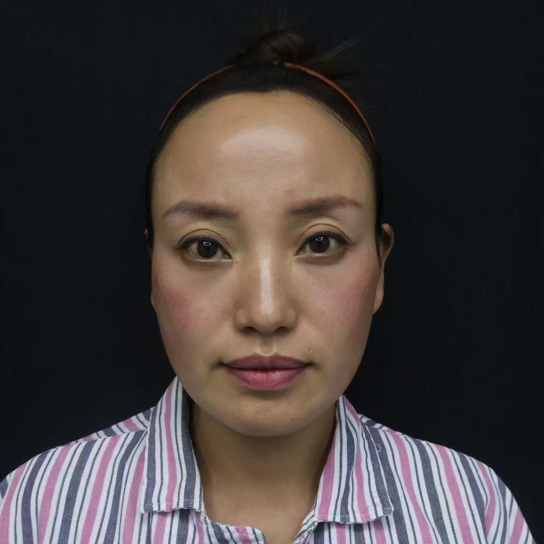婷婷变美日记