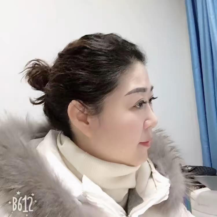 向阳花