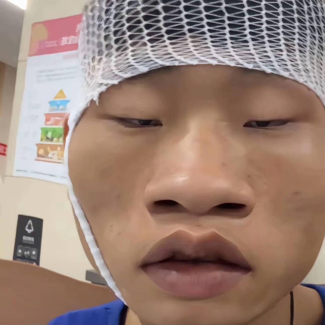 兜不住屎被护工暴打