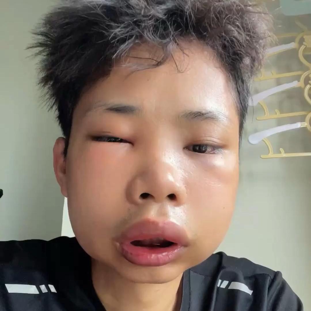 王百万（在种牙）