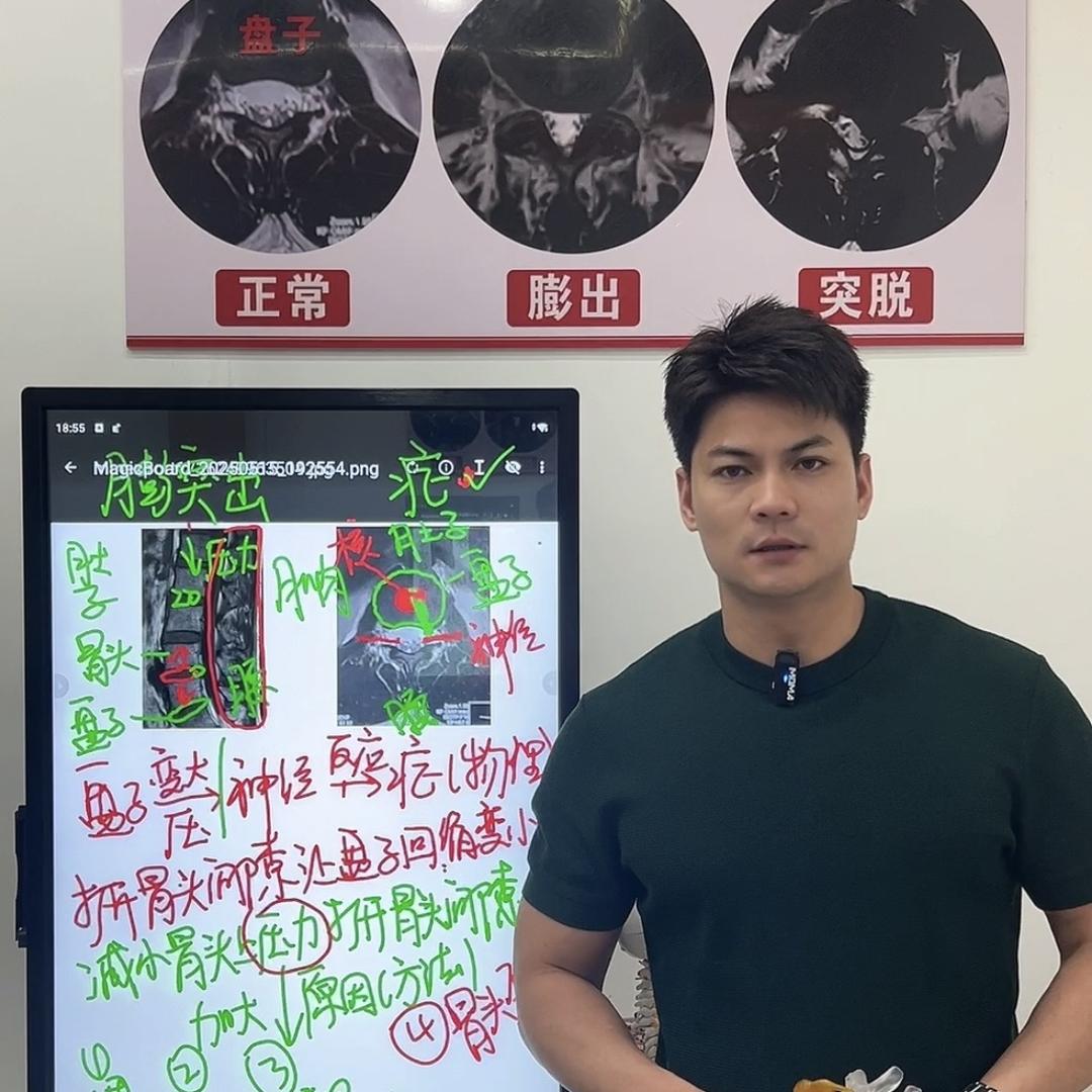 黄教腰突运动KF