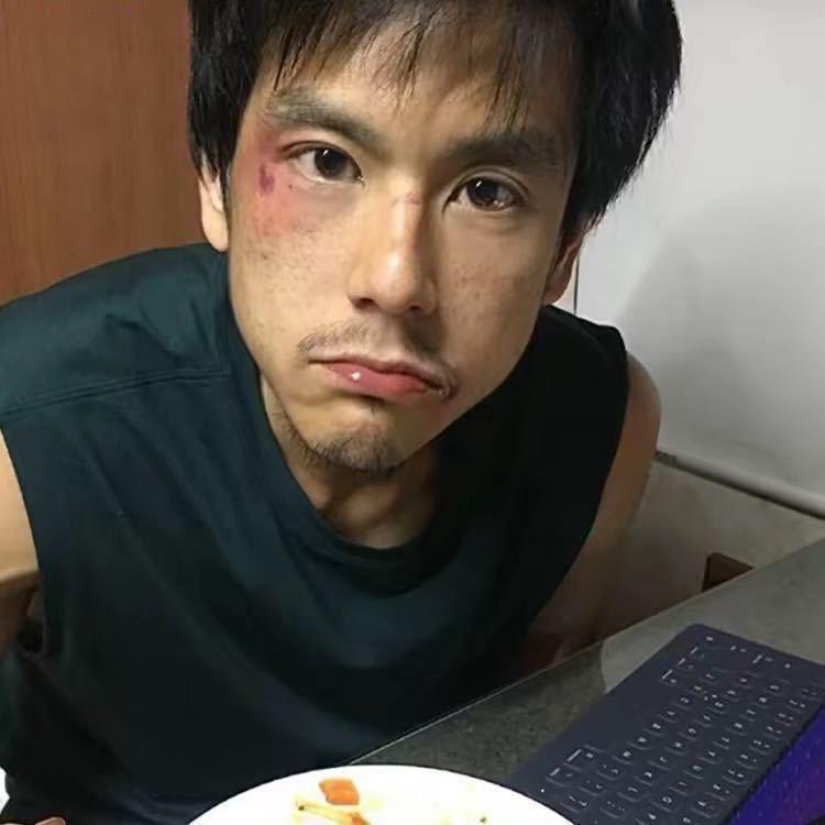 余鱼🐟