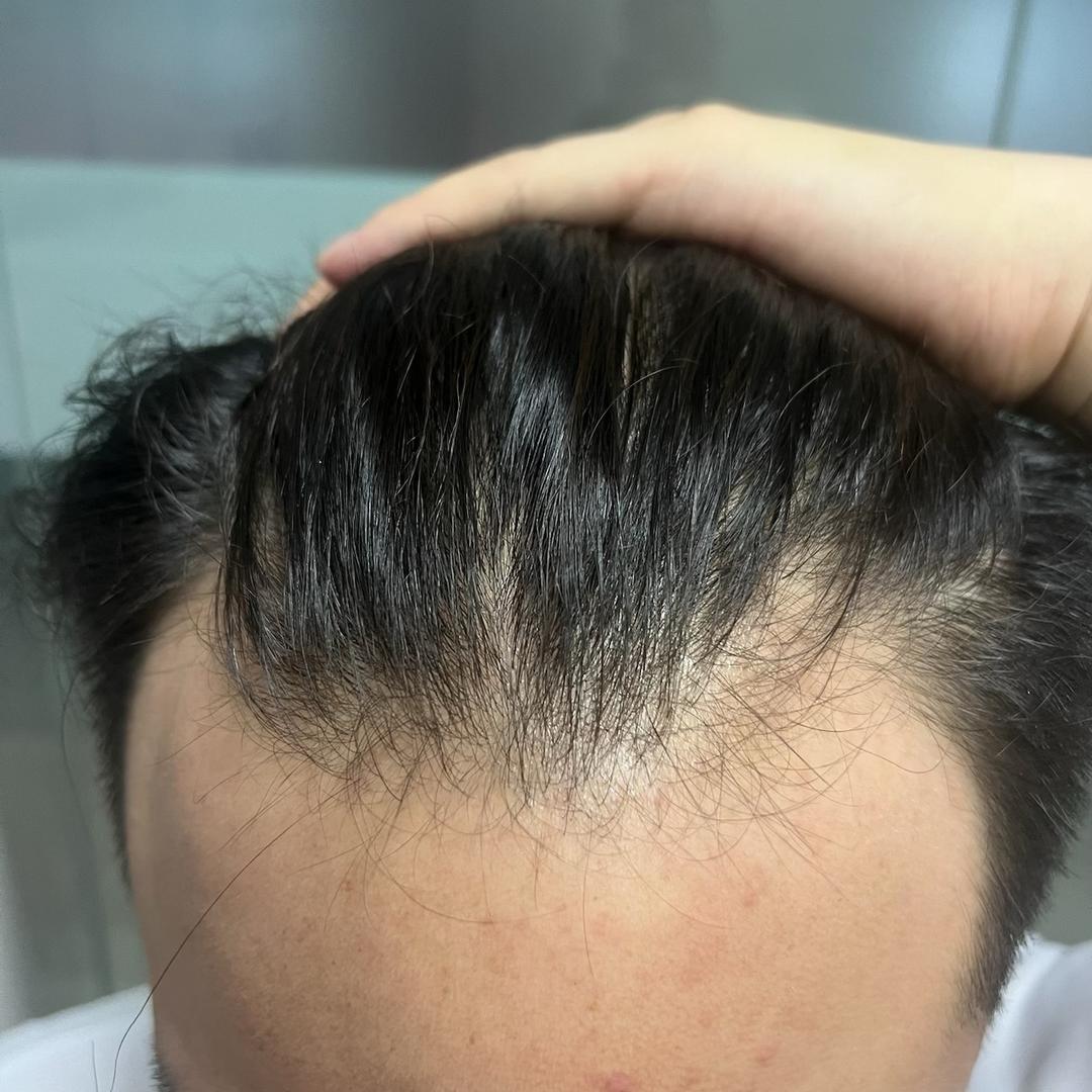 秃头野马日记分享