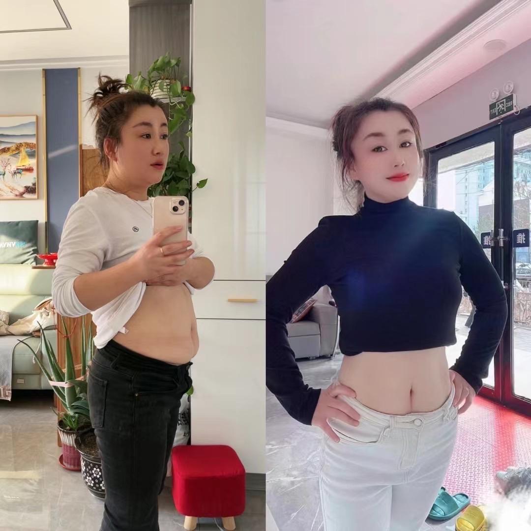瑞菁瘦丽人专业减肥榆树店赵丽
