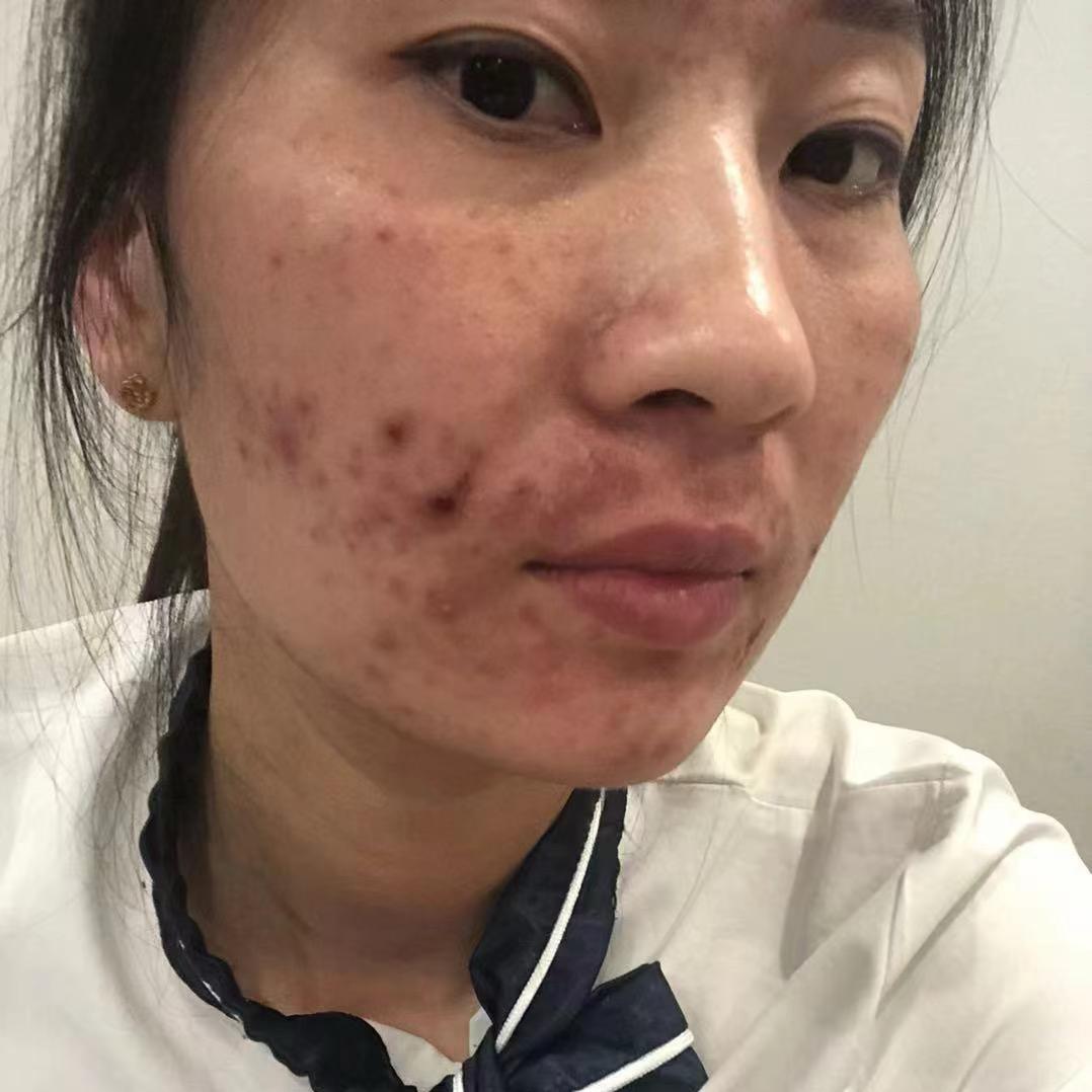 劉kk