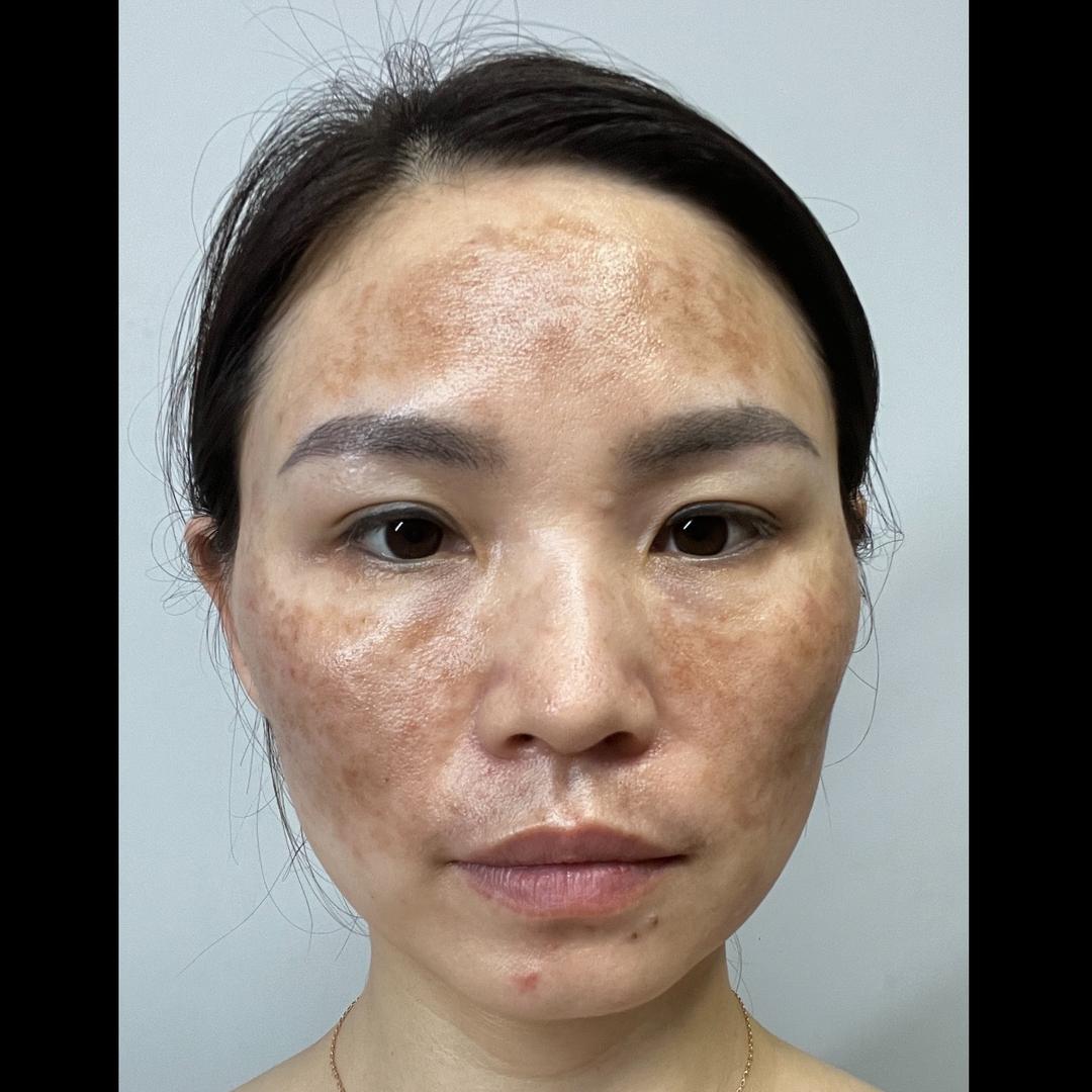 娇妍