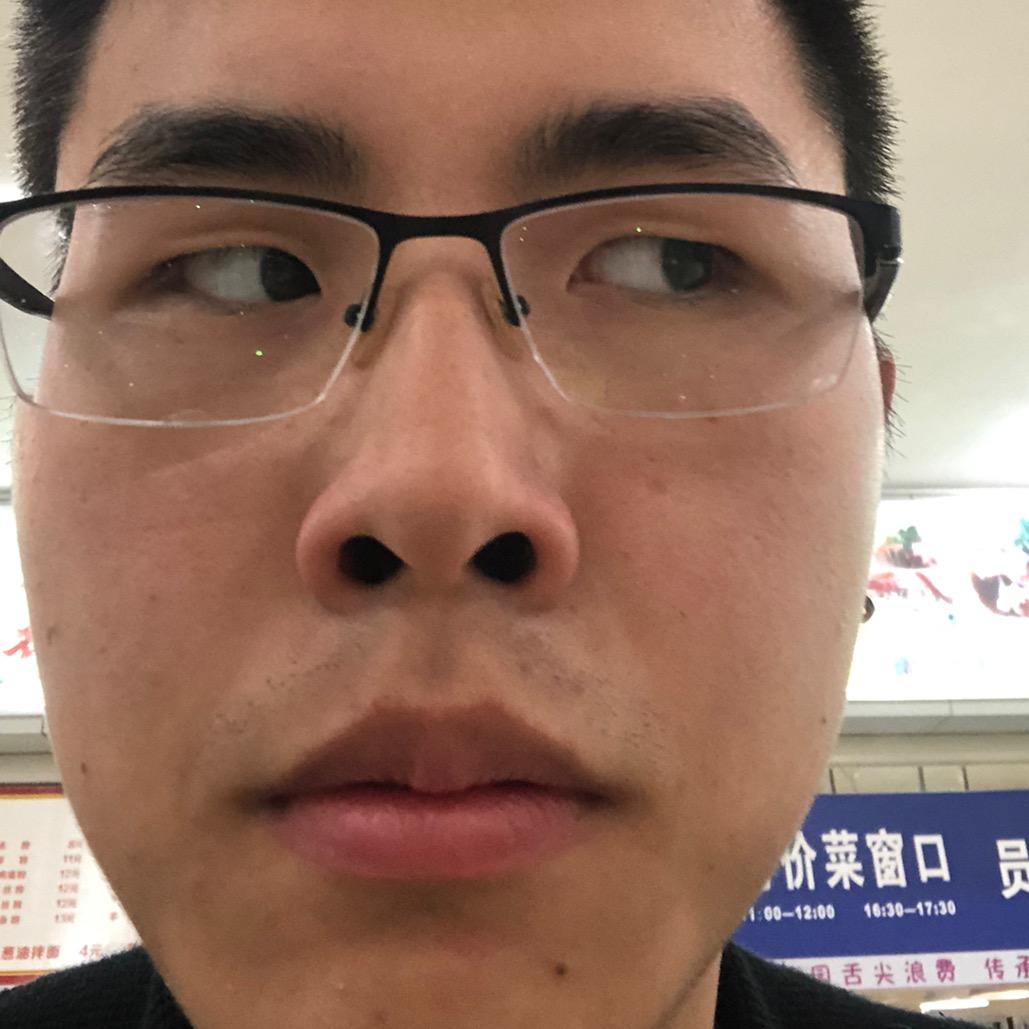李有点疯