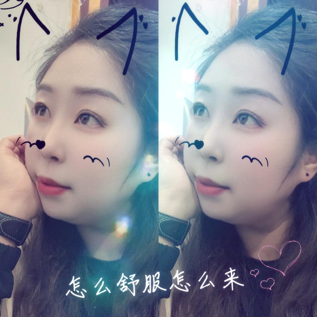 海疙瘩