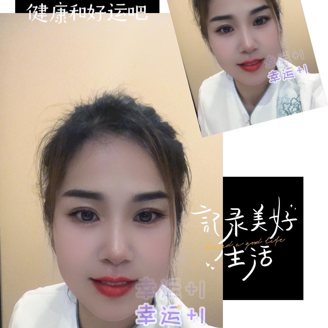 玲玲ᵎ(•̀㉨•́)و ̑̑ 加油