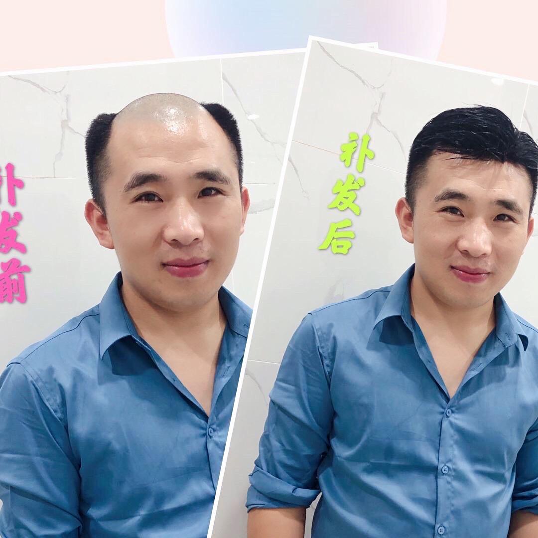运城发饰美假发 〈杨勇〉