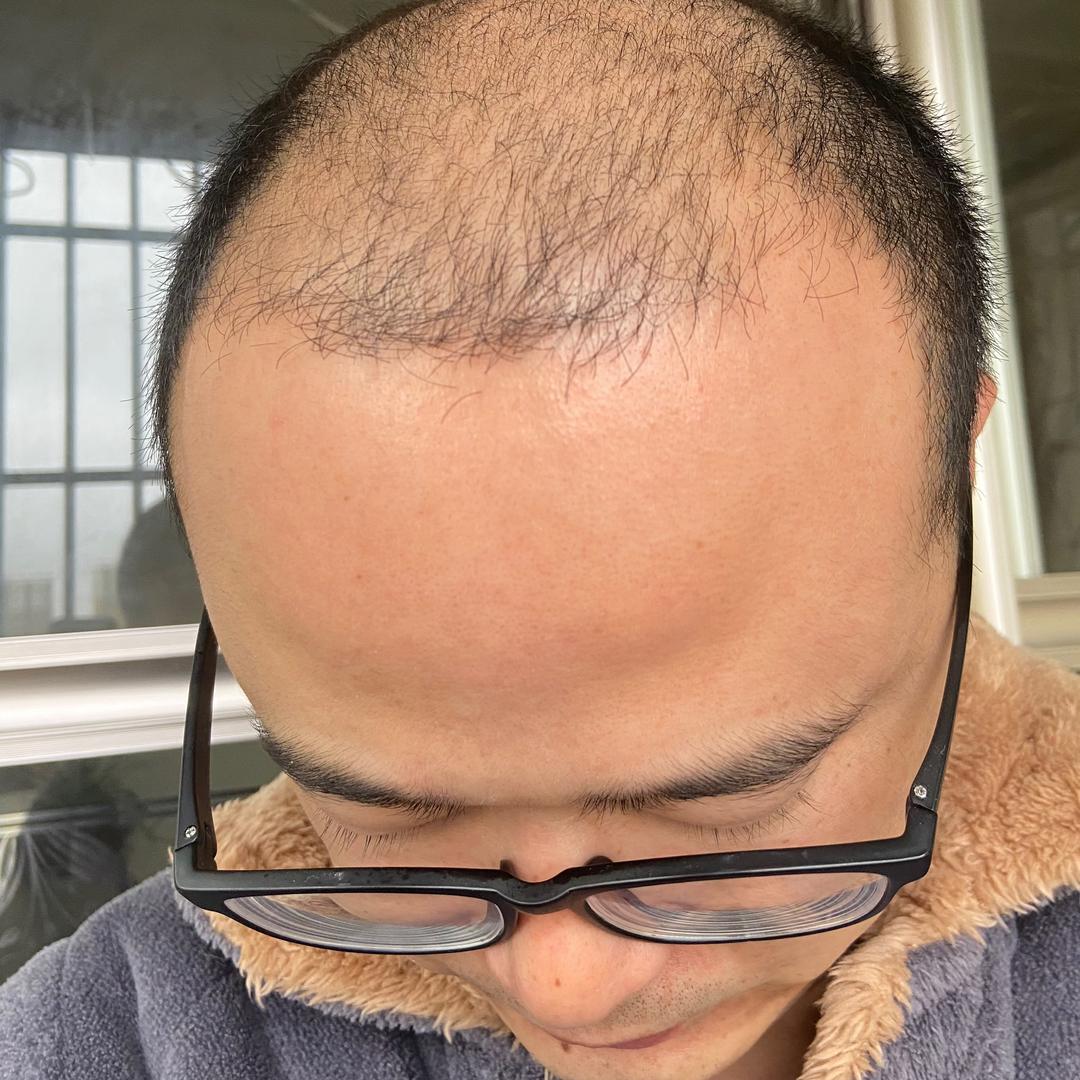 曼哥不秃秃文化