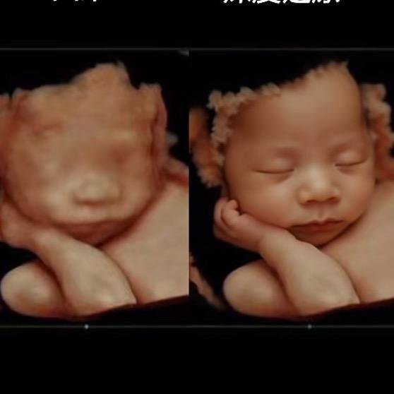 星星妈妈，还原图片