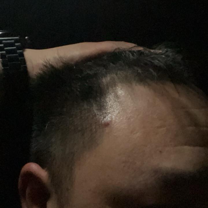 简单！