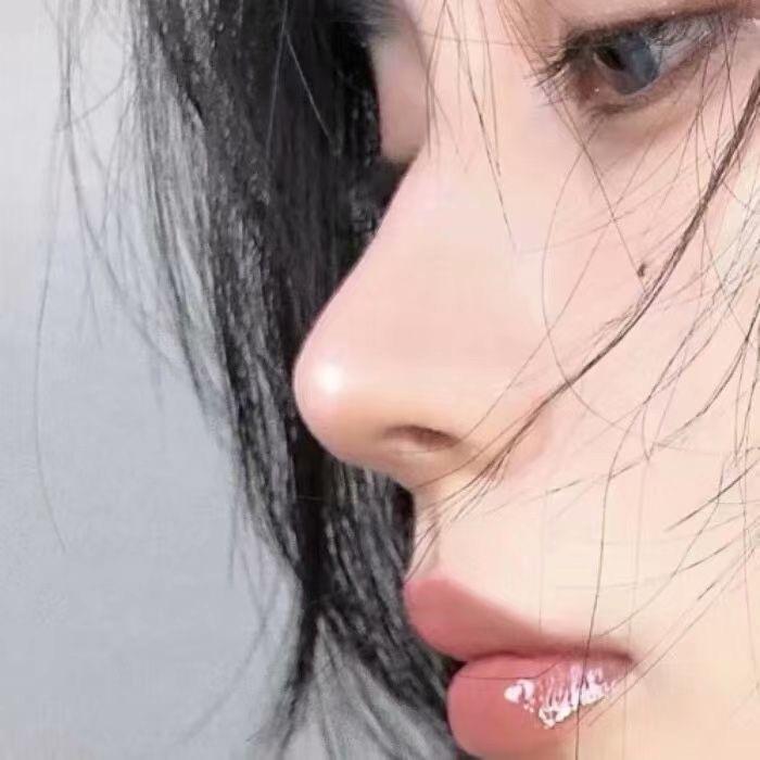KOI·