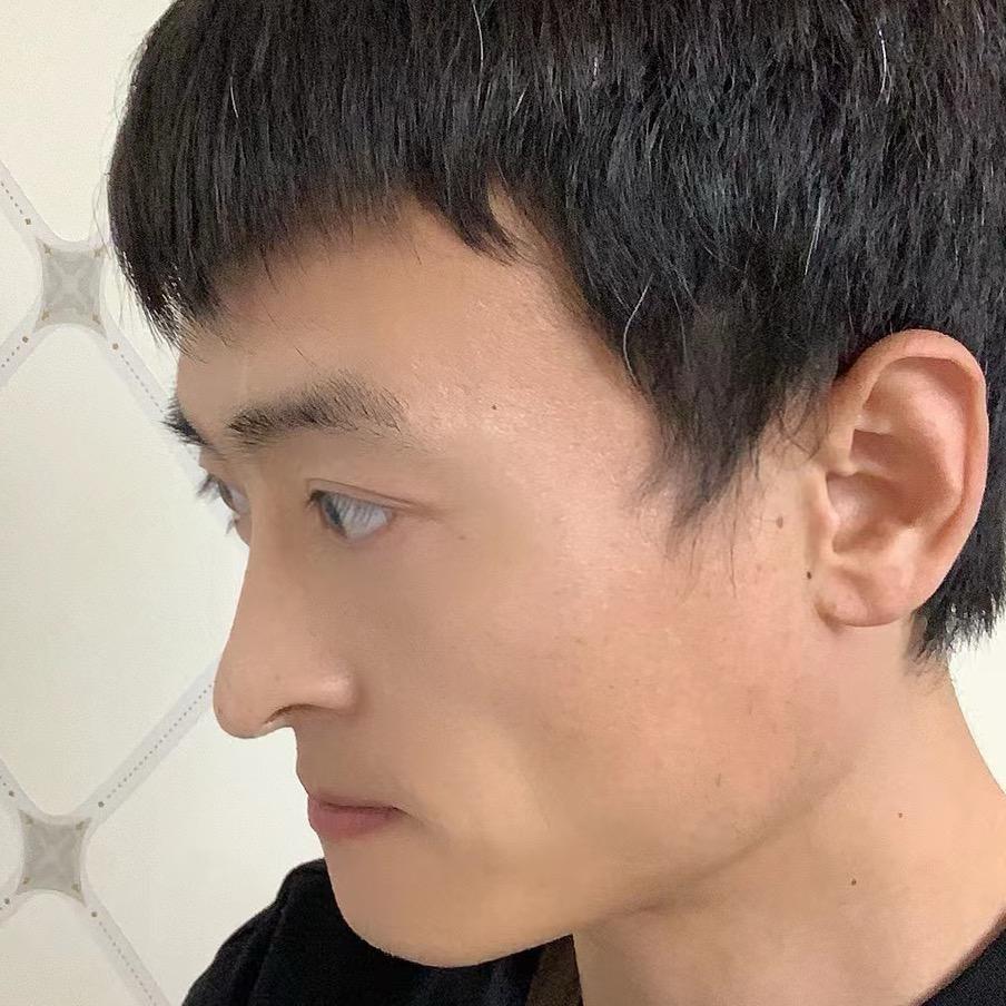 鼻子