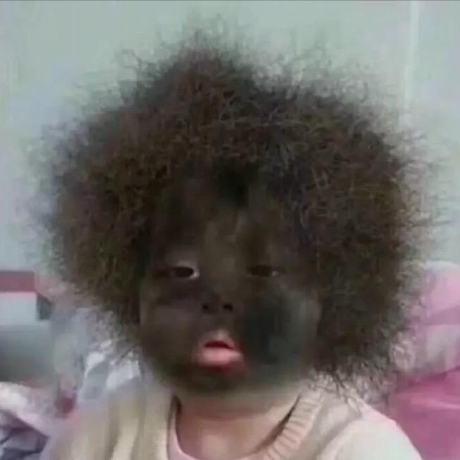 77.