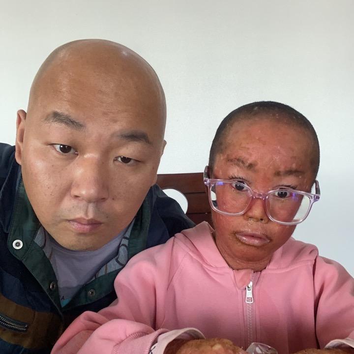 小丫头