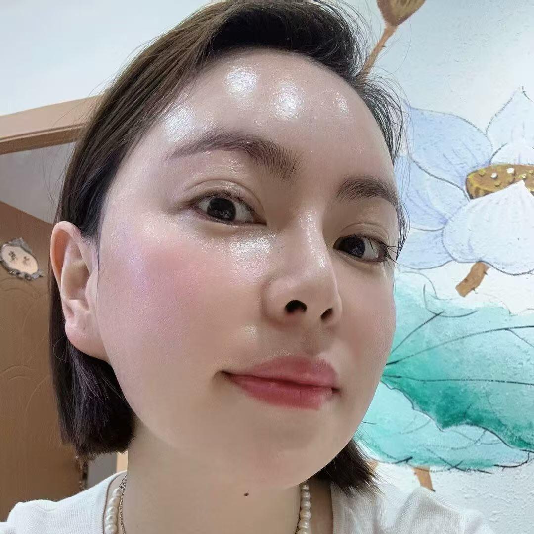 LD皮肤管理崔姐