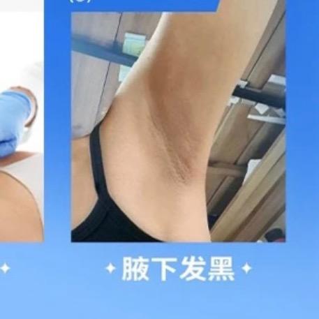 倾龄香体净腋霜