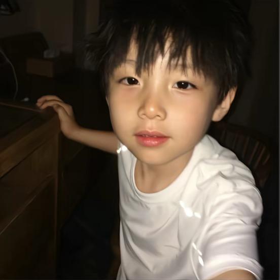 她说我双眼皮是割的