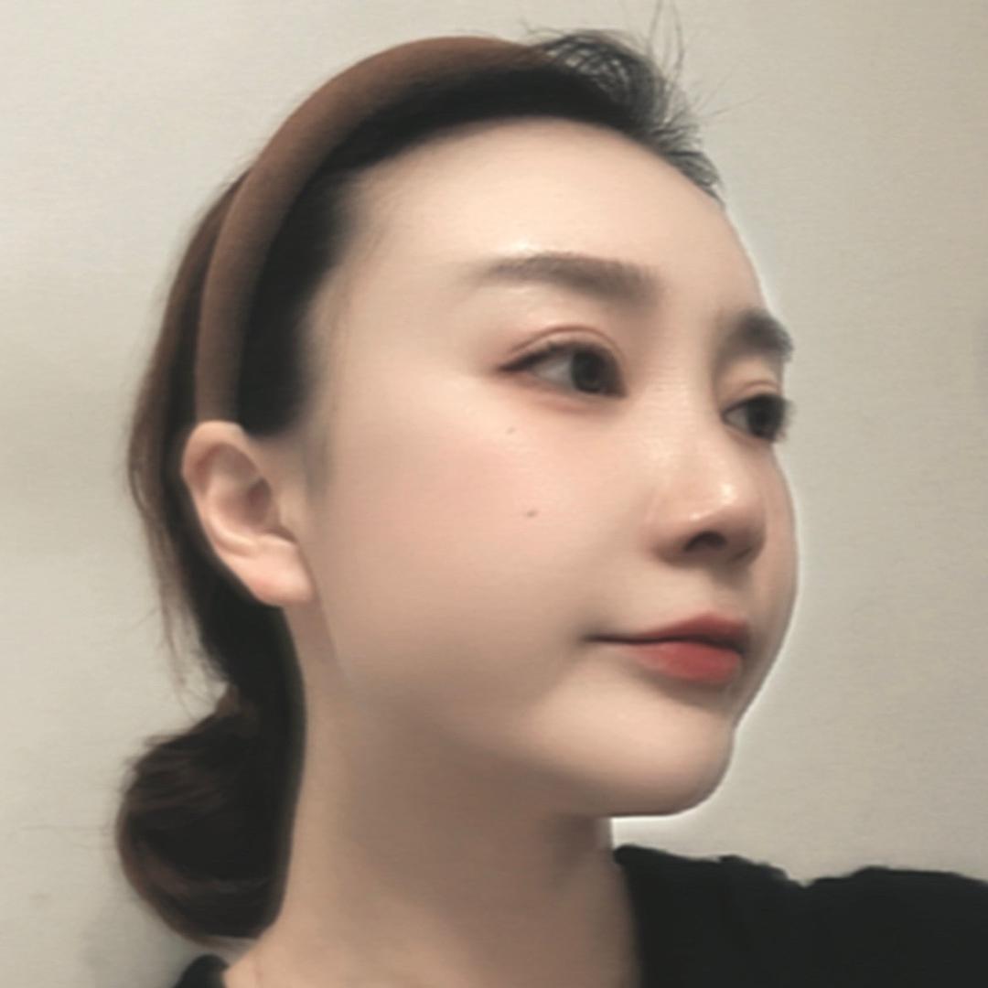 我该往哪跑