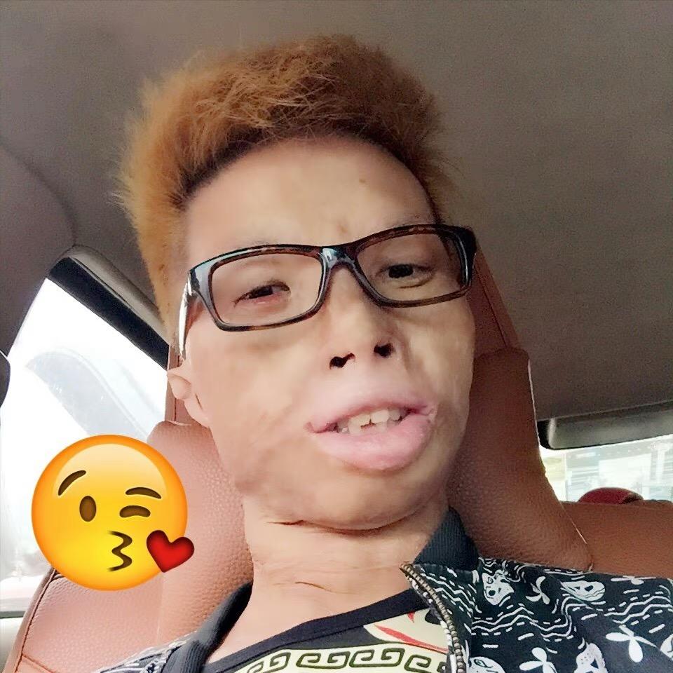 烧伤哥🎤胡亚武