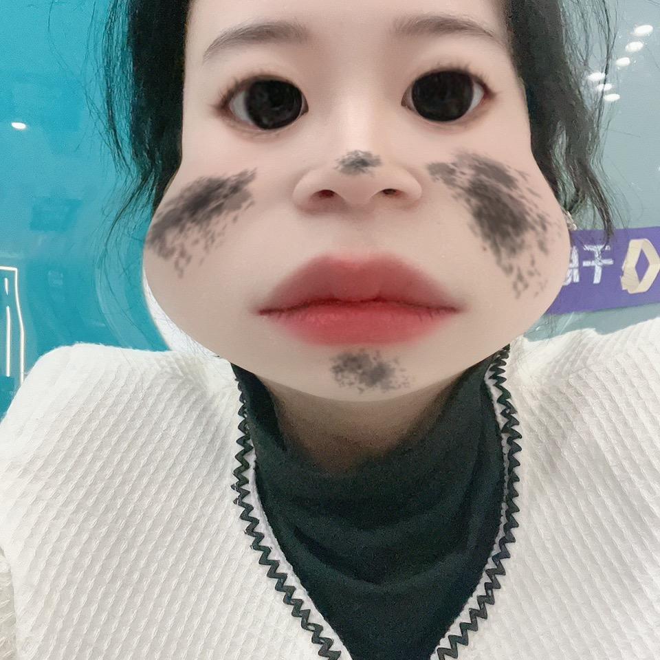 井月