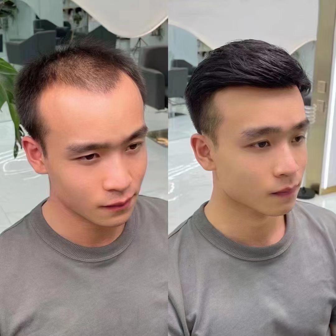 乌鲁木齐假发补发