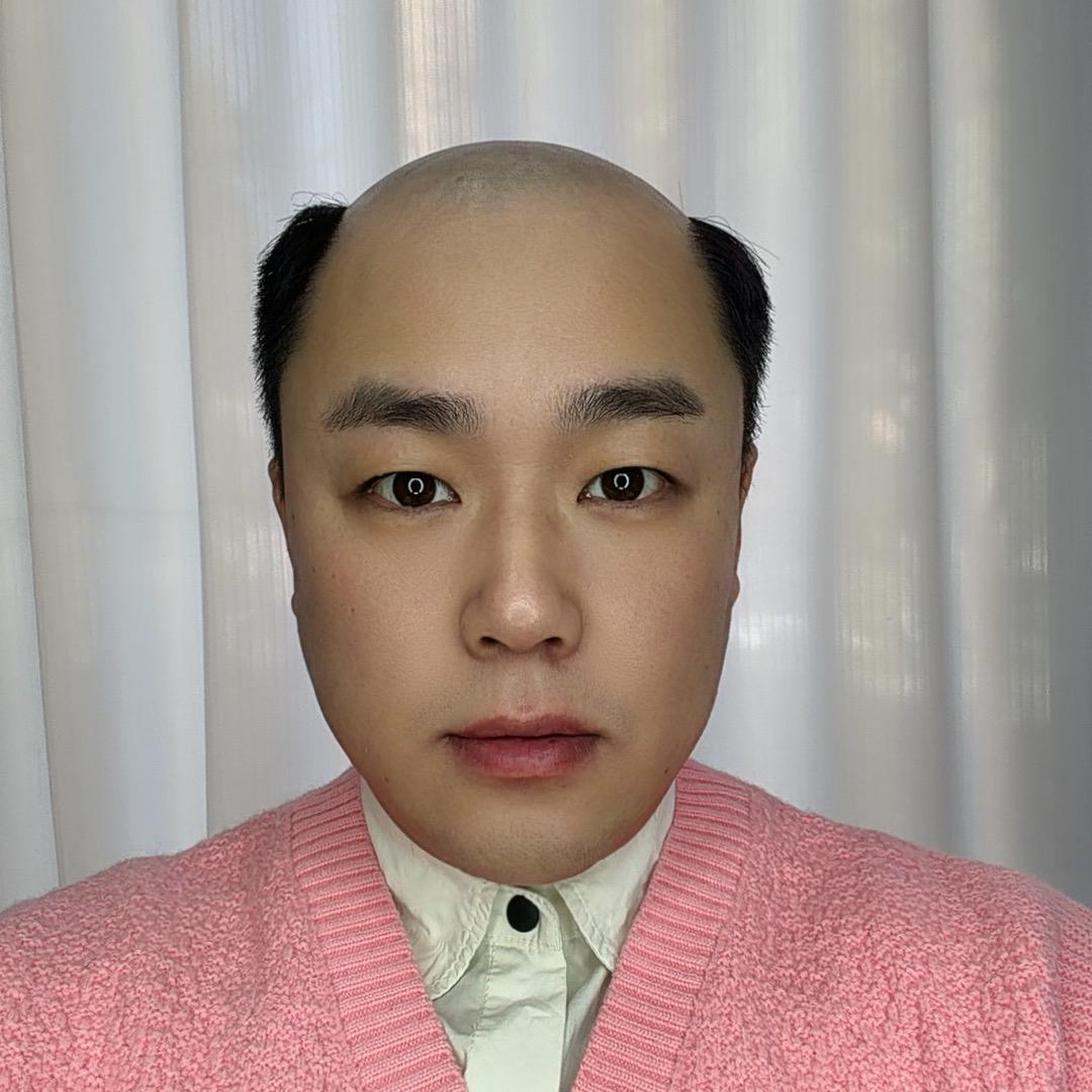 忻州假发补发：小峰