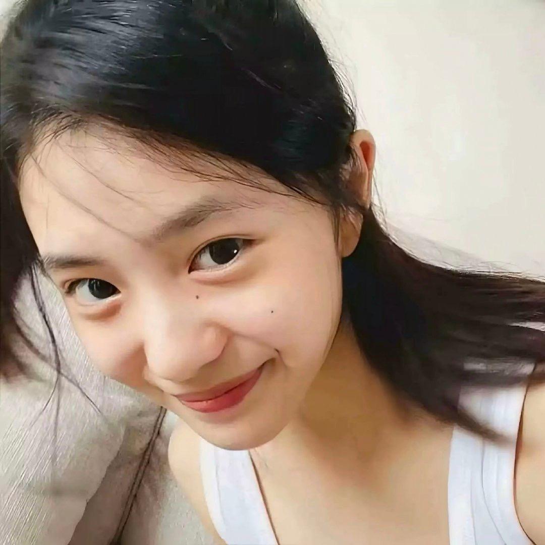 卖萌被打掉两颗门牙