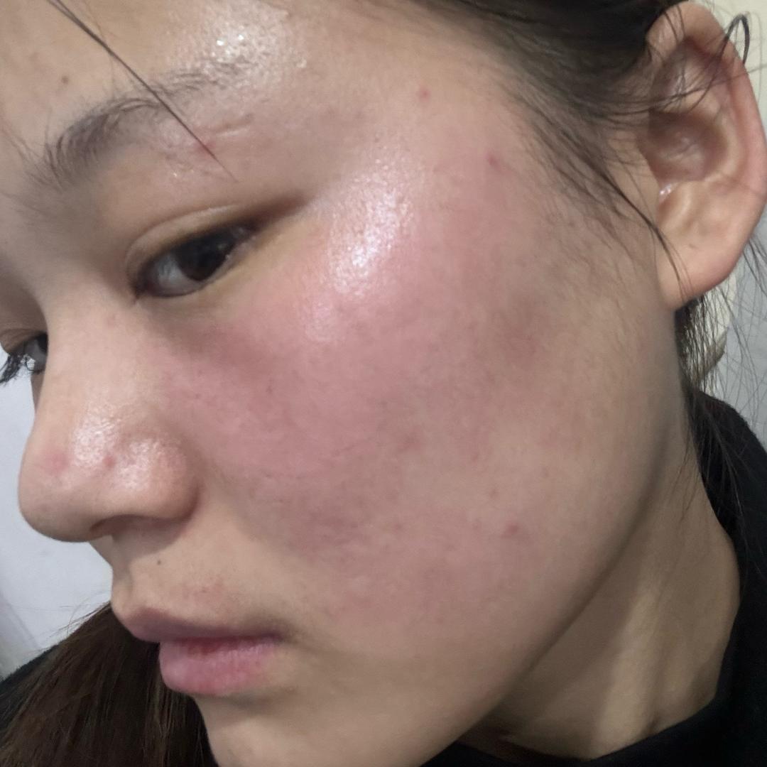 修丽诗小蝶（敏肌两年多）