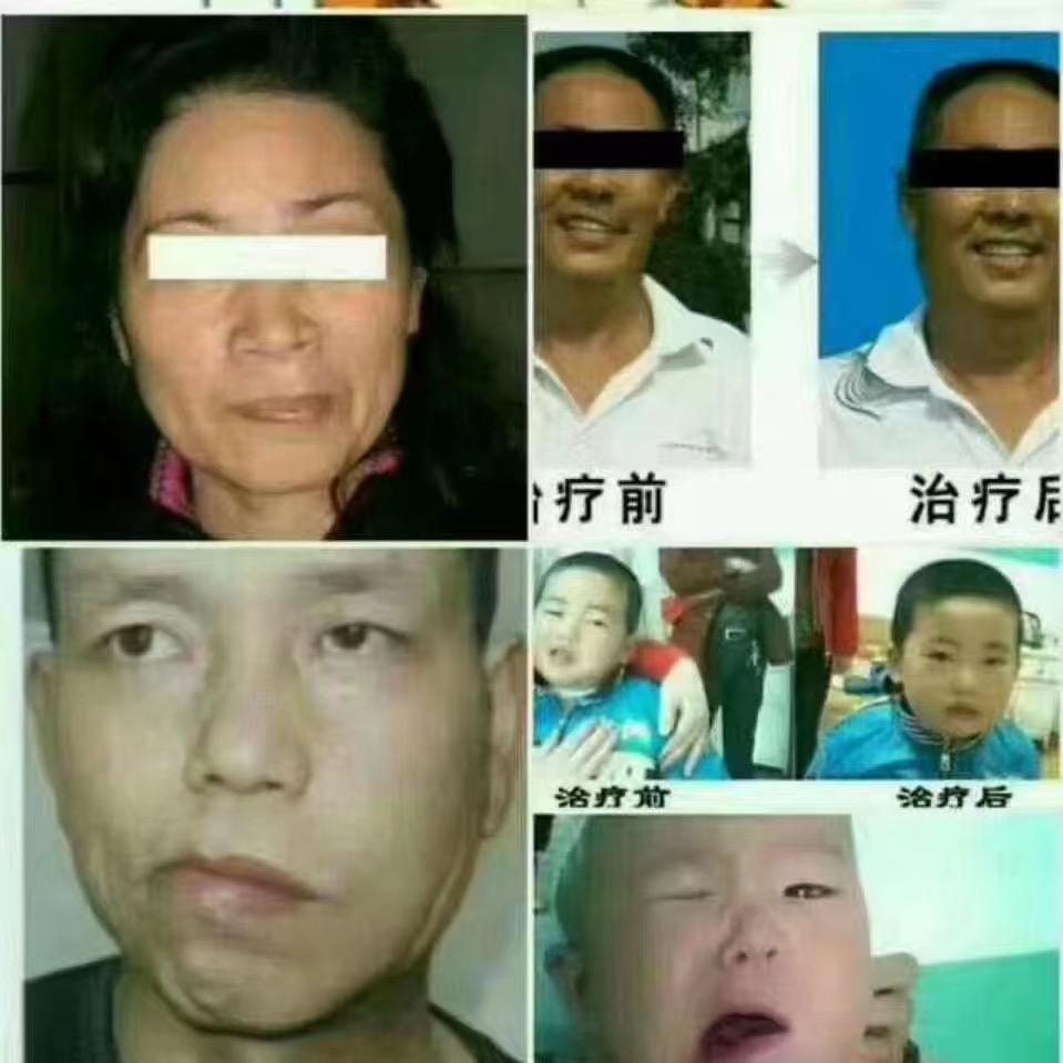面瘫霸州一片☁️云