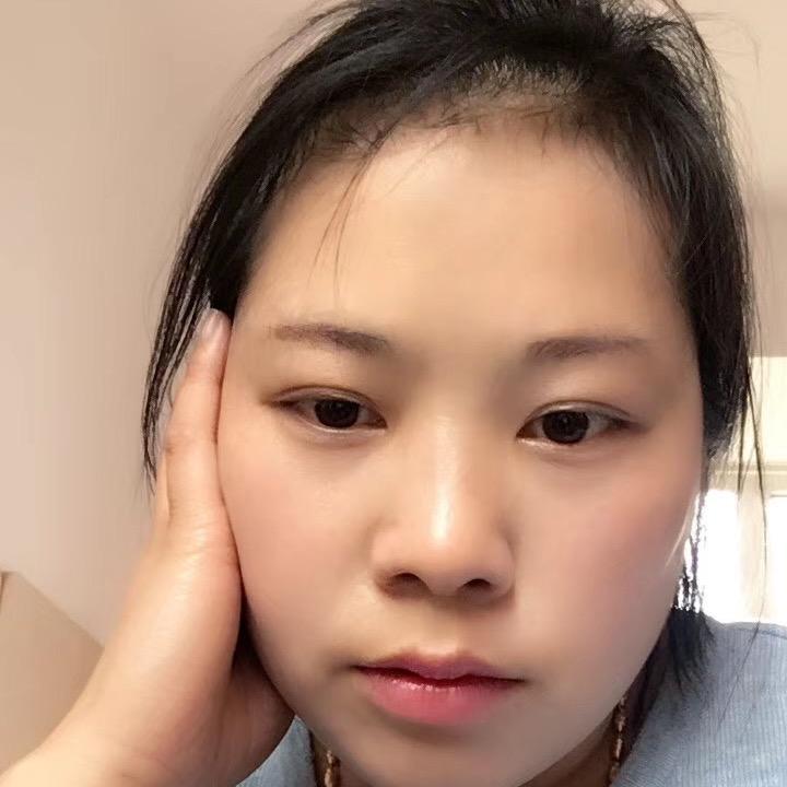 阿雪