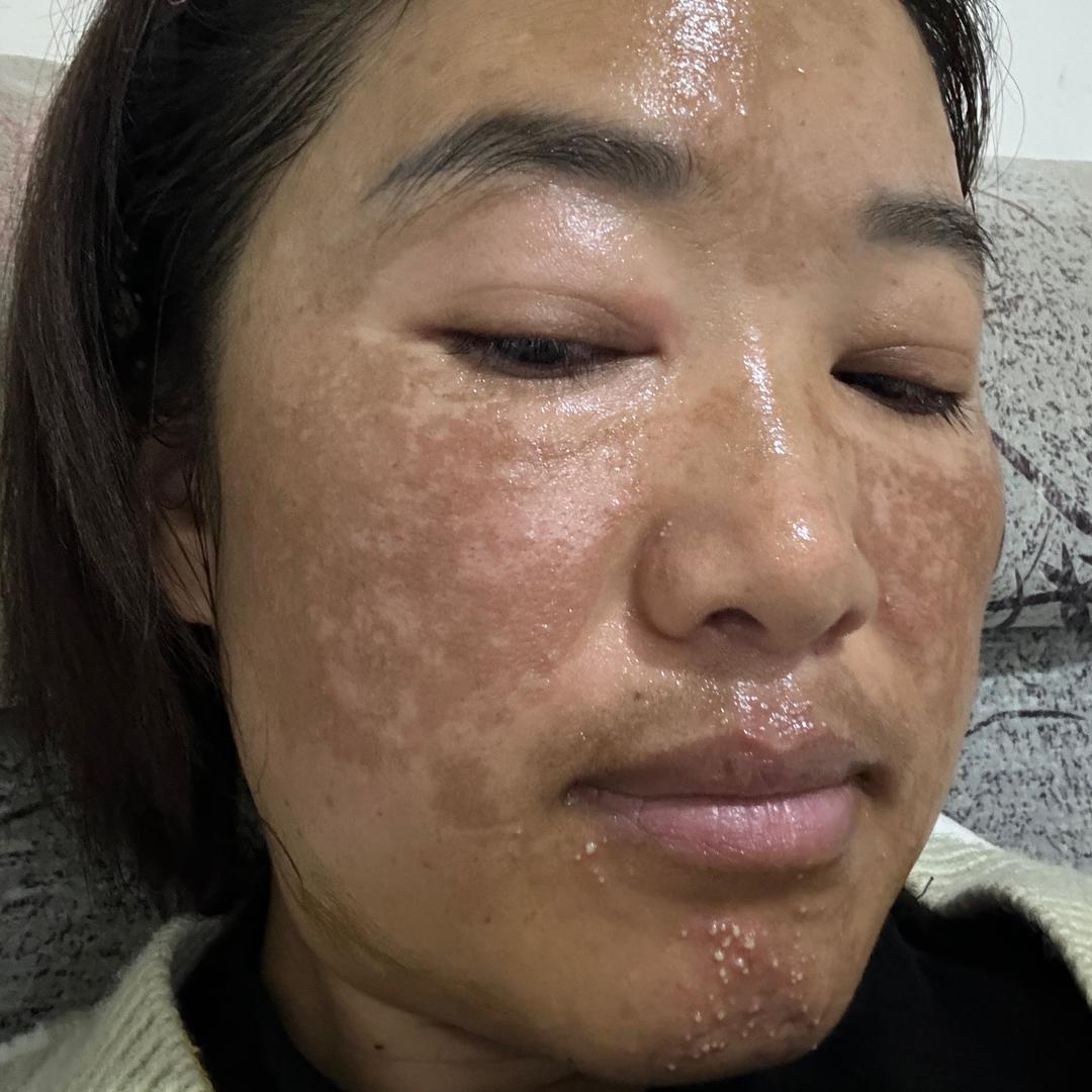 琴琴在改变